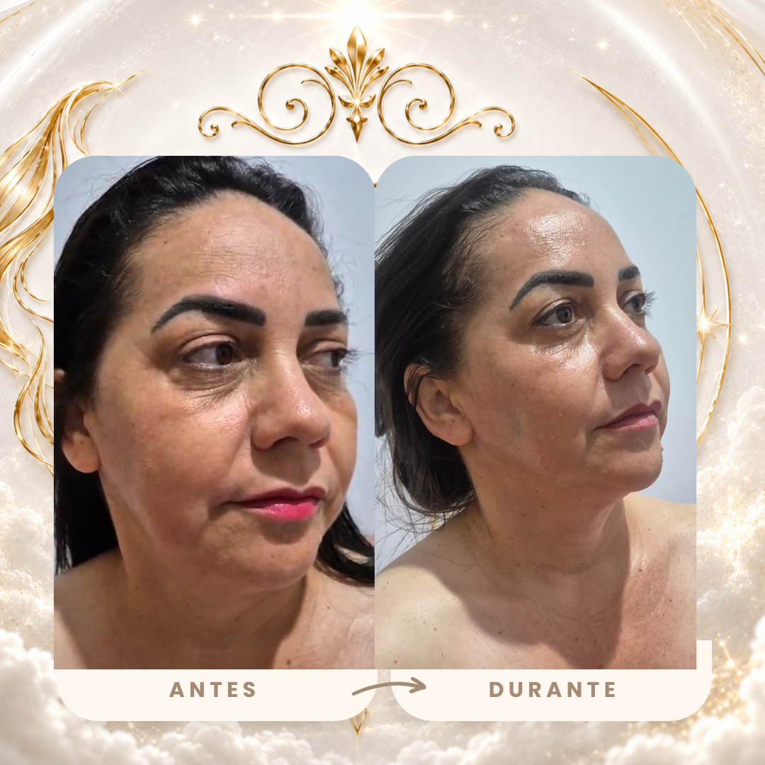 Antes e durante real — olhar mais descansado e rejuvenescido