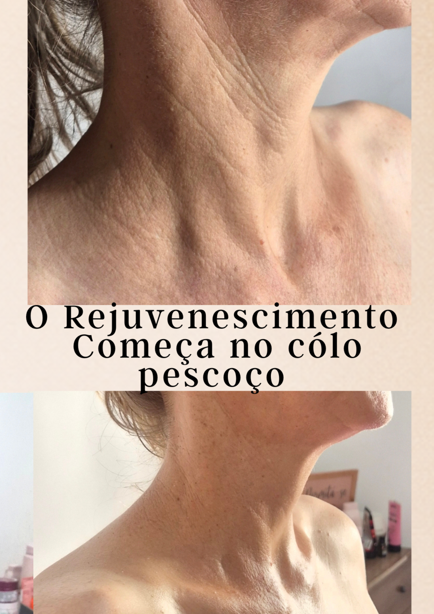 Rejuvenescimento começa no colo e pescoço