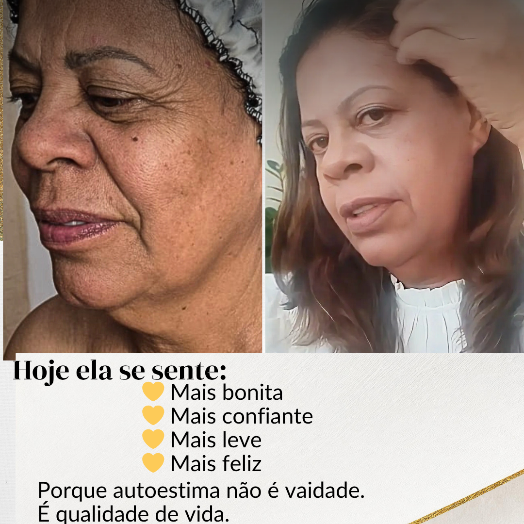 Resultado real mostrando rosto e pescoço com aparência mais leve e definida