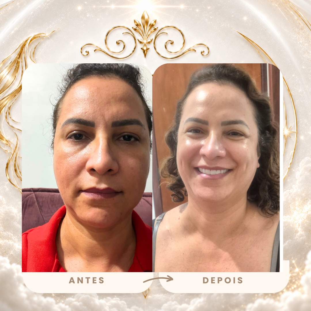 Antes e depois real — pele mais luminosa e sorriso renovado