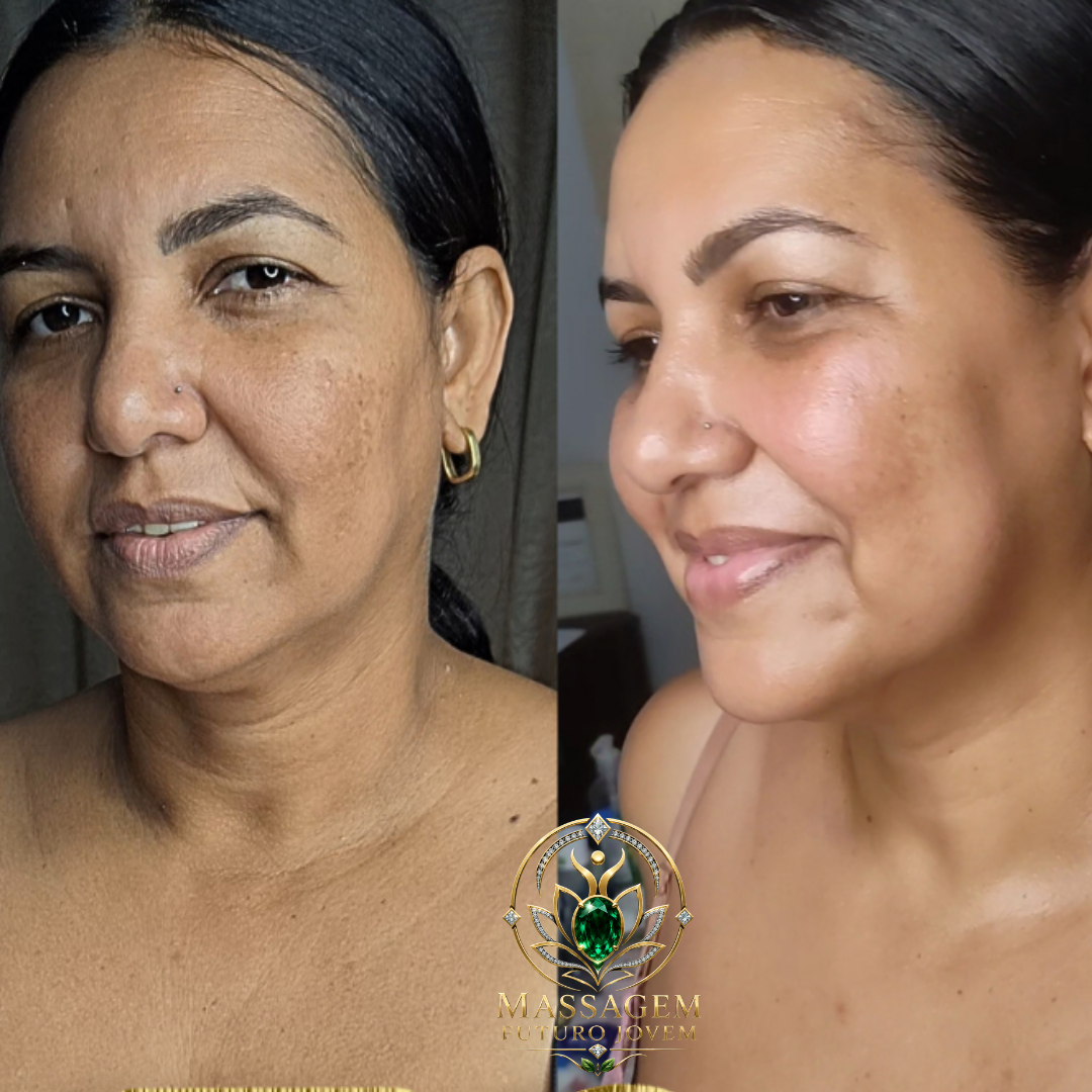 Antes e depois lateral mostrando rosto mais firme e iluminado